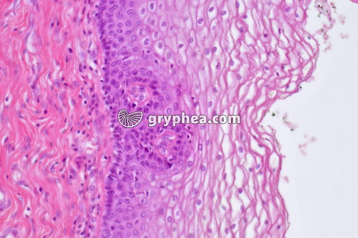 Muqueuse vaginale x100 - gryphea.com